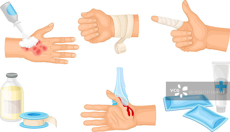 受伤的皮肤和处理过程图片素材