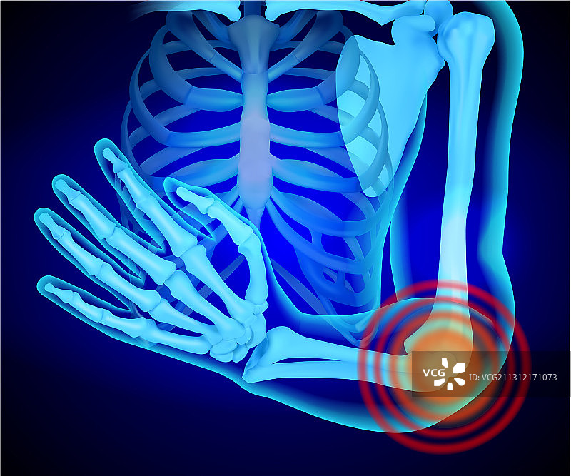 X光人体手部肩部解剖图图片素材