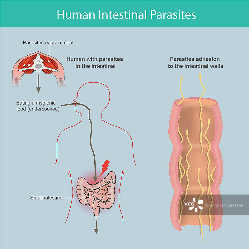 人类肠道寄生虫科普图片素材