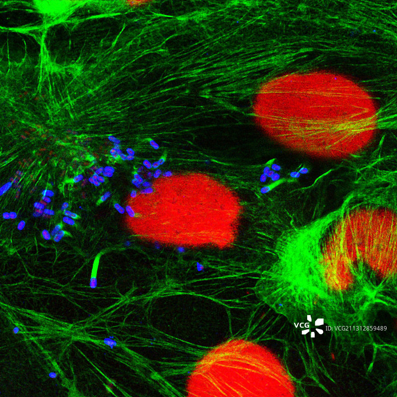 肠道组织中的志贺氏菌，光学显微照片图片素材