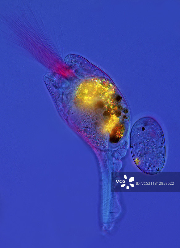 领环虫轮虫显微照片图片素材