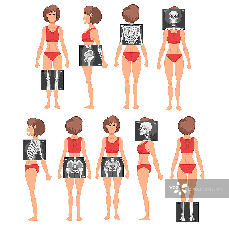 X光检查场景：年轻女子正在接受检查图片素材