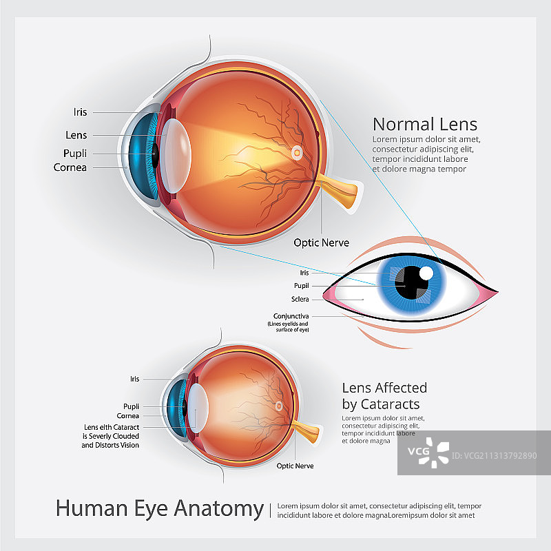 人眼解剖结构图片素材