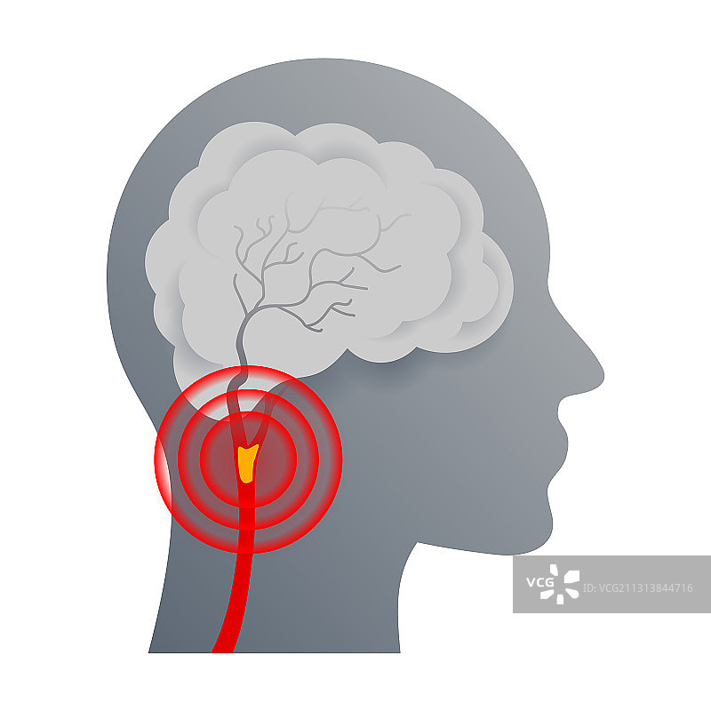 脑血管缺血性疾病图标图片素材