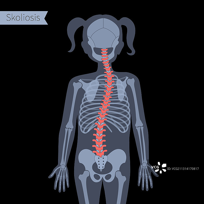 脊椎X光图片素材