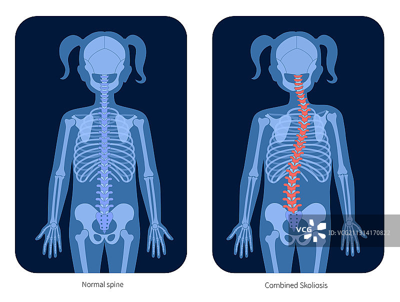 脊椎X光图片素材