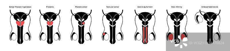 生殖系统概念图片素材