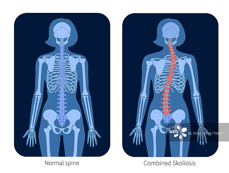 脊椎X光图片素材