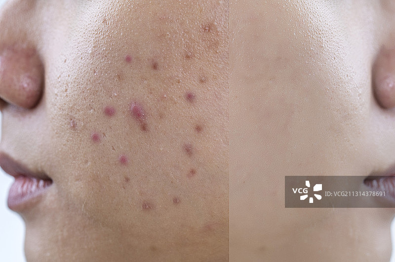 青年女人皮肤对比图图片素材