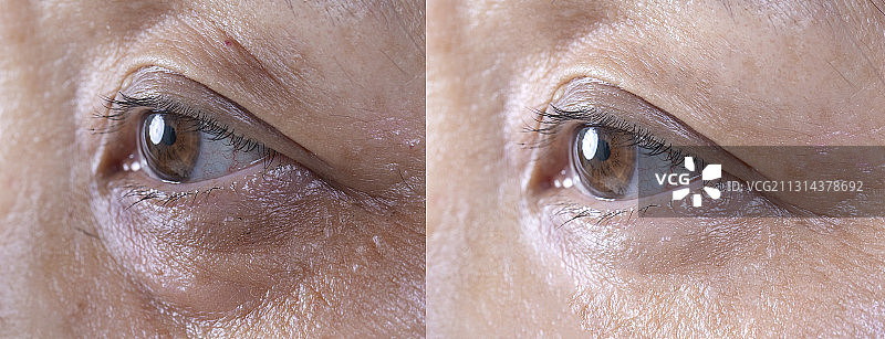 老年女人眼睛对比图图片素材