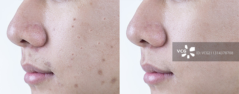 青年男人皮肤对比图图片素材