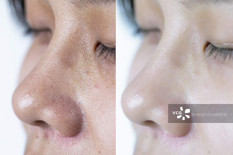 青年女人皮肤对比图图片素材
