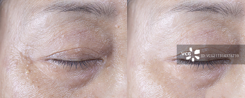 老年女人眼睛对比图图片素材