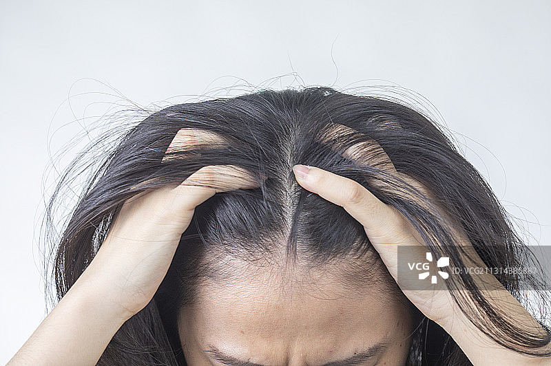 青年女人烦恼落发图片素材