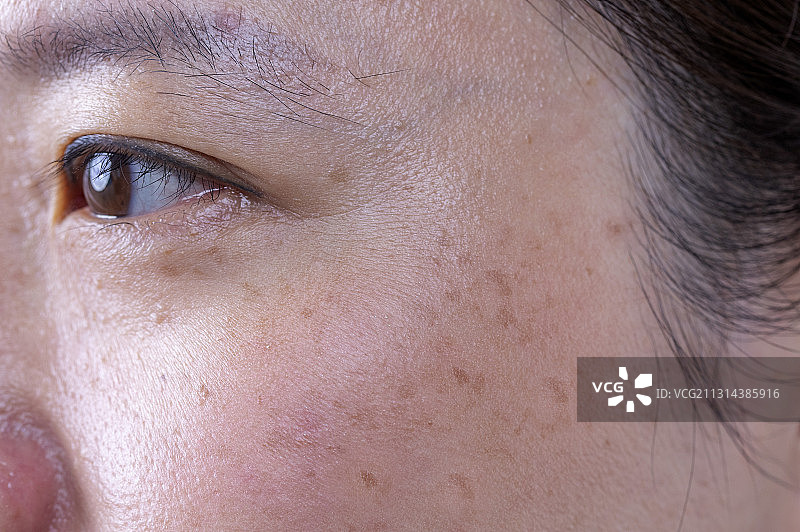 中老年女人的雀斑图片素材