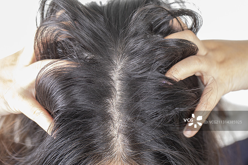 青年女人的黑眼圈图片素材