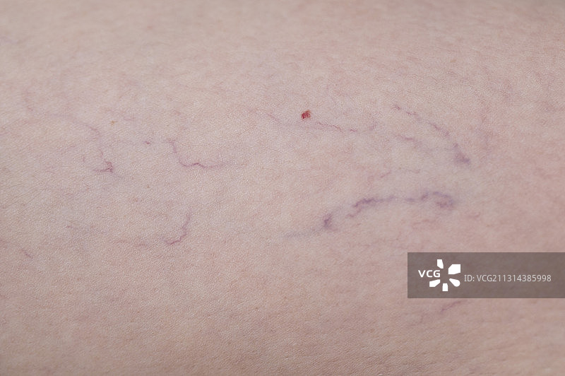 中老年女人脚的皮肤图片素材