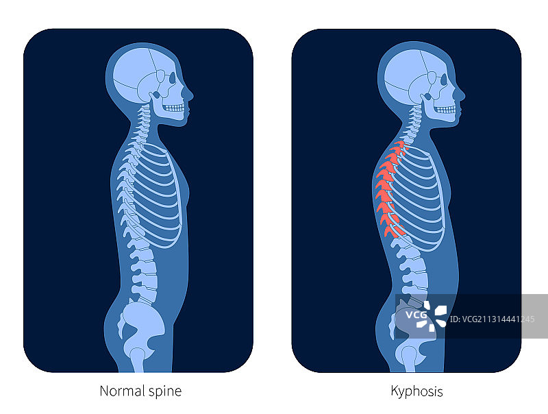 脊椎X光图片素材