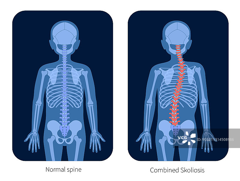 脊椎X光图片素材