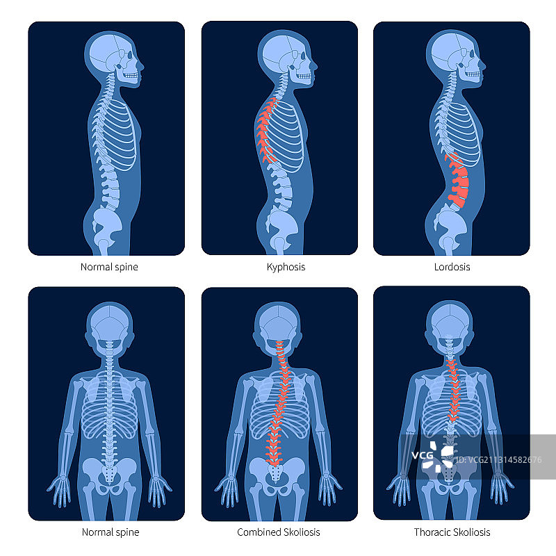 脊椎X光图片素材