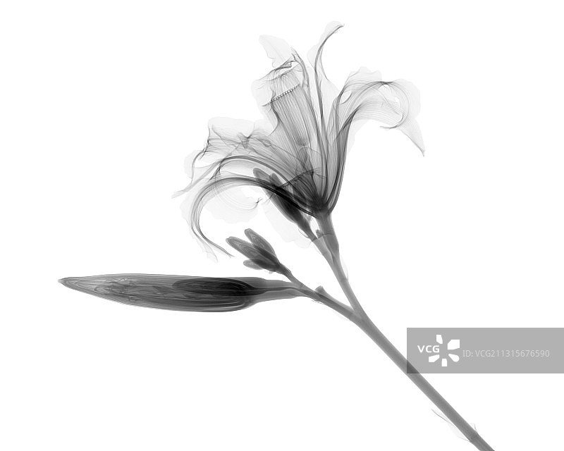 莉莉的x光片图片素材