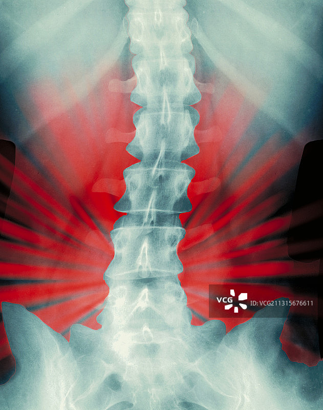 背部疼痛图片素材