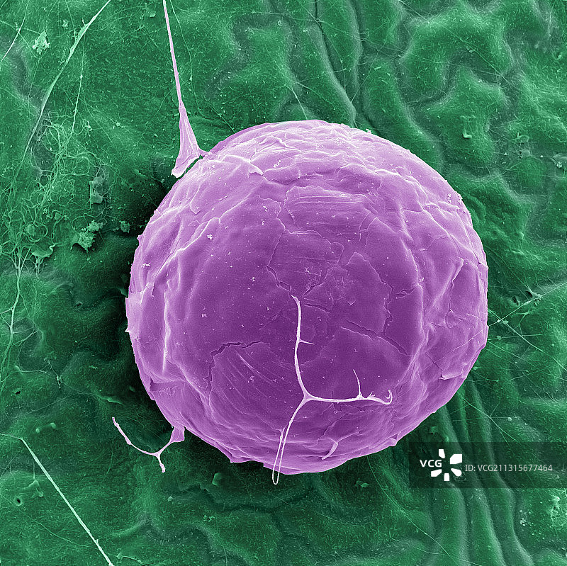 螨虫卵囊扫描电镜图图片素材