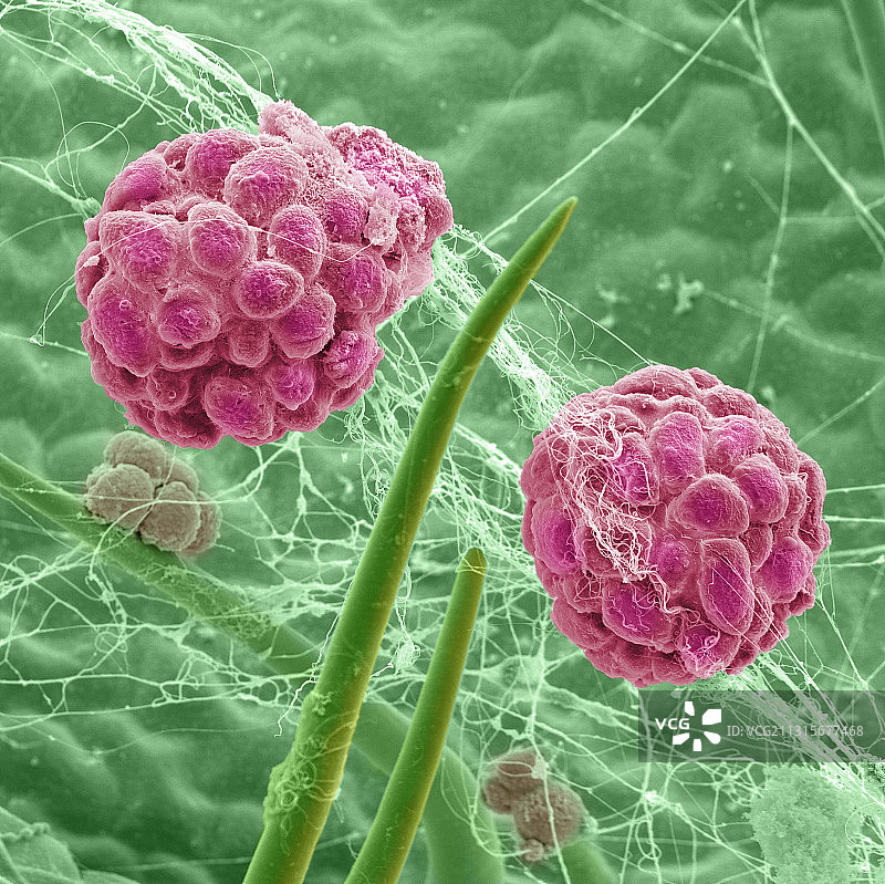 螨虫卵囊扫描电镜图图片素材