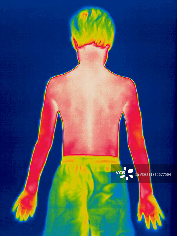 穿着短裤男孩的热成像图（背面）图片素材
