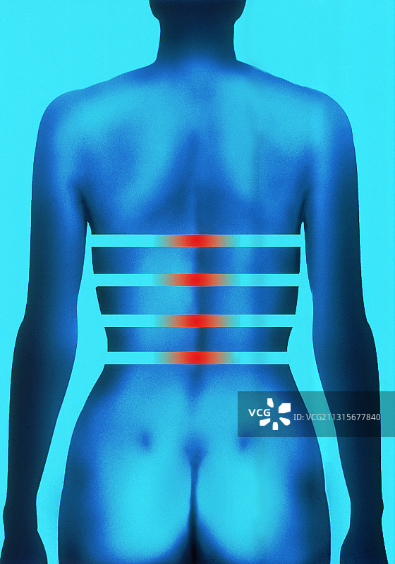 背痛图片素材
