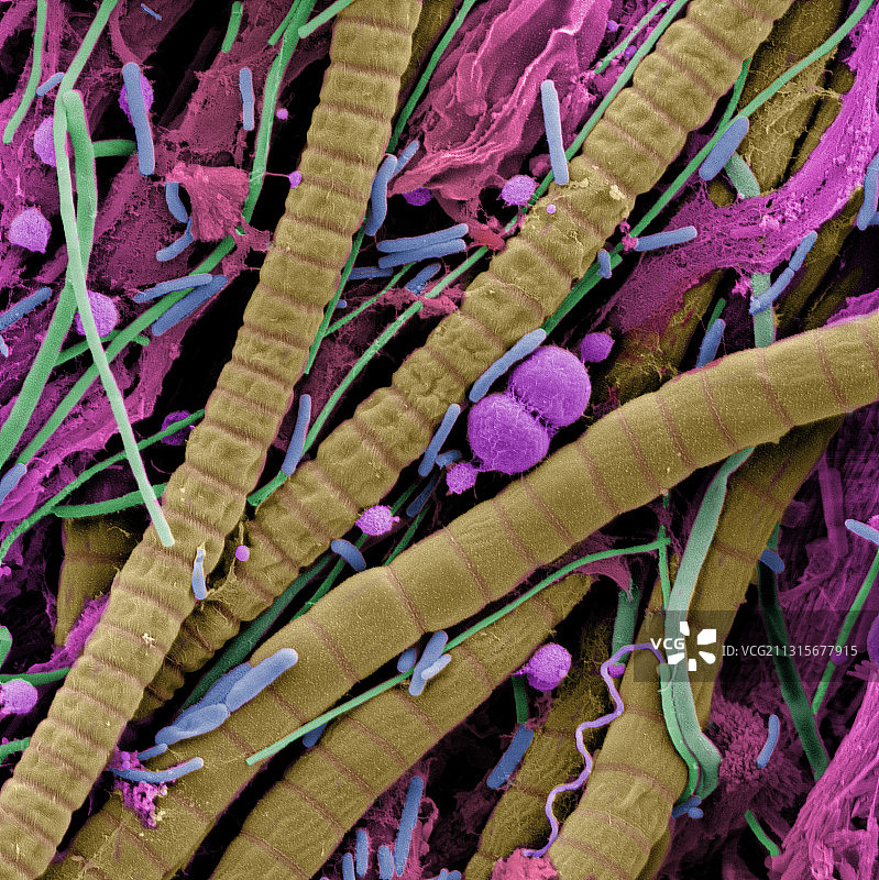 极端微生物群落扫描电镜图图片素材