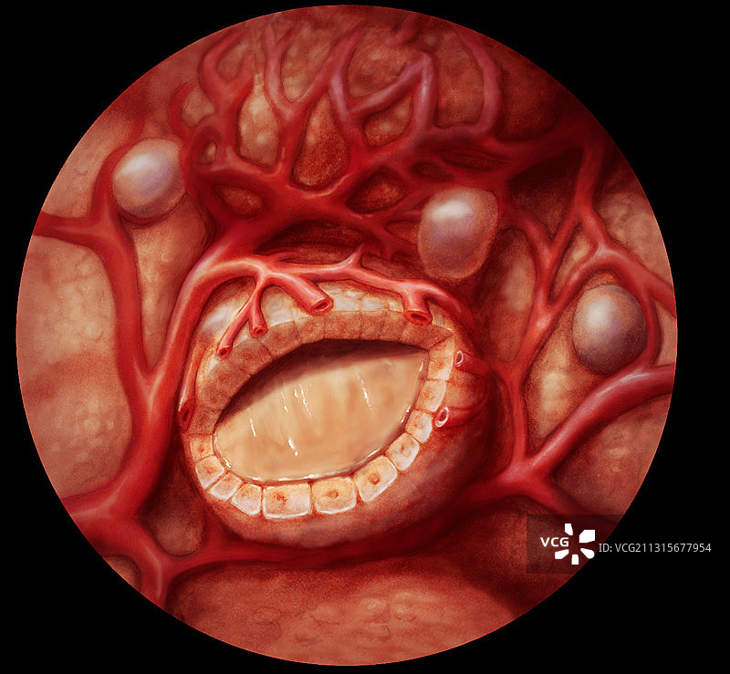 甲状腺滤泡图片素材