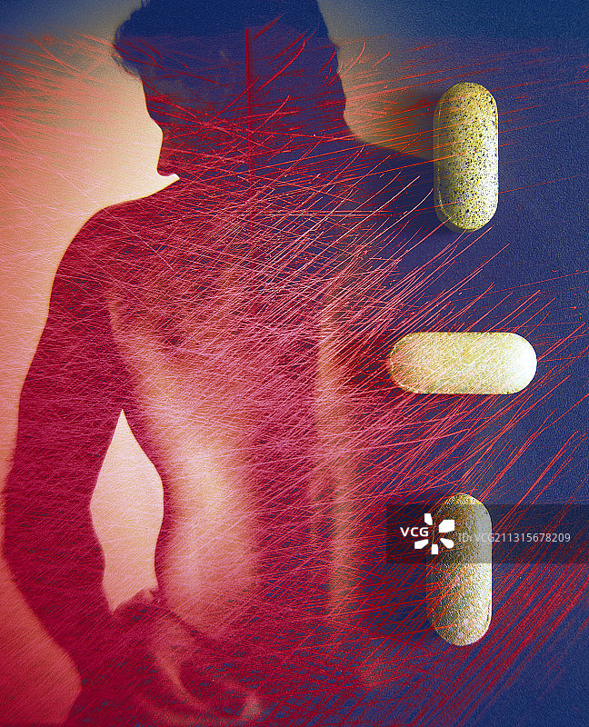 背痛与药物治疗图片素材