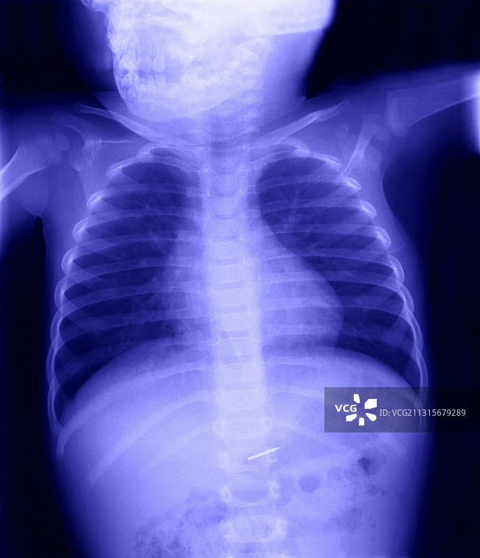 吞下的钉子图片素材