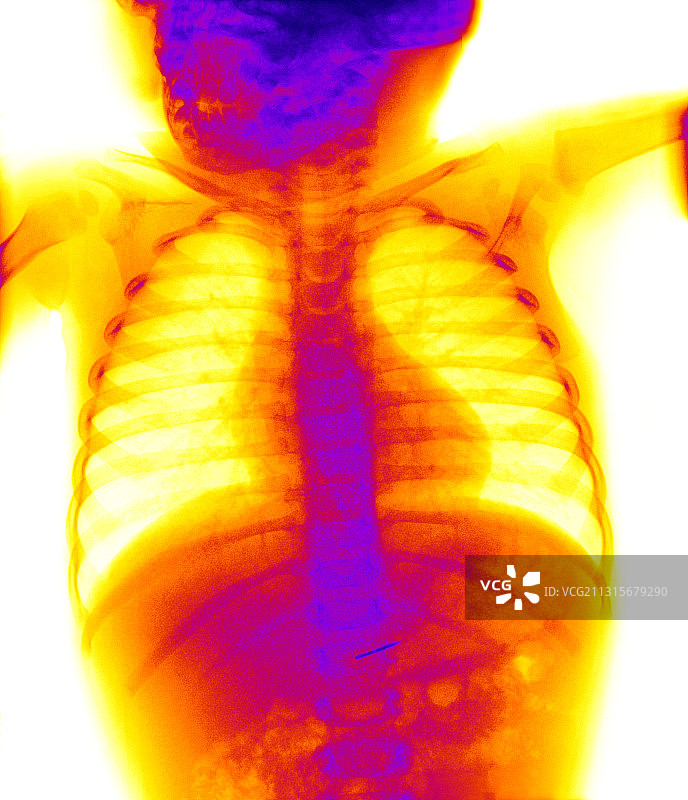 吞下的钉子图片素材
