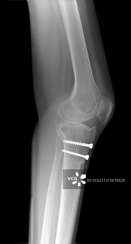 膝关节图片素材