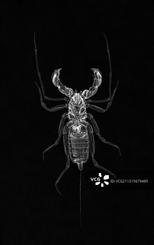 鞭蝎X光图片素材