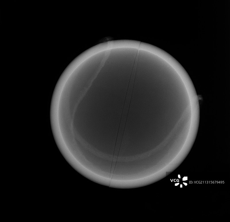 网球X光片图片素材
