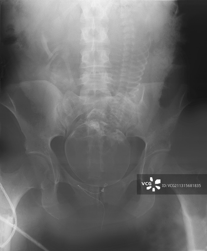 人类诞生图片素材