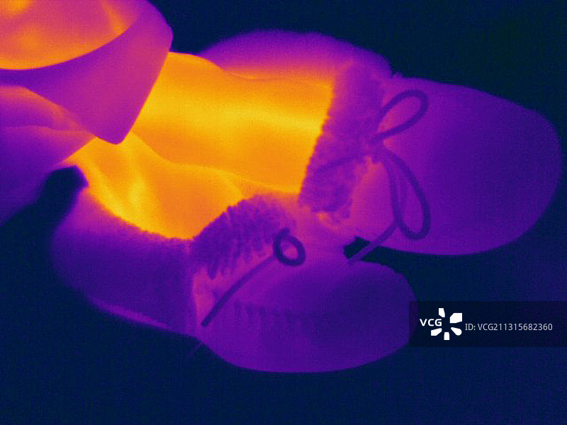 拖鞋中的脚部热成像图图片素材