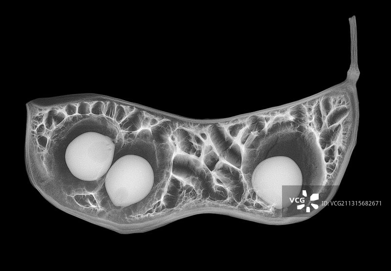 肯塔基咖啡树豆荚的X光片图片素材