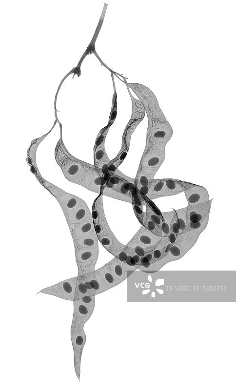 无刺皂荚树的X光片图片素材