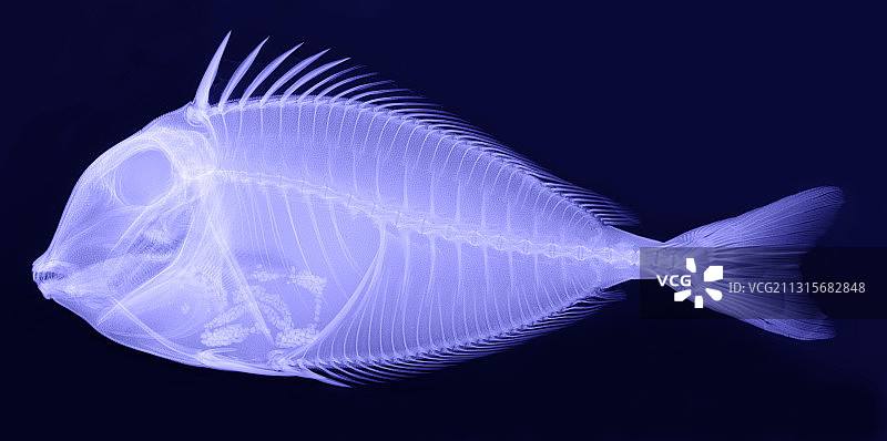 刺尾鱼的X光片图片素材