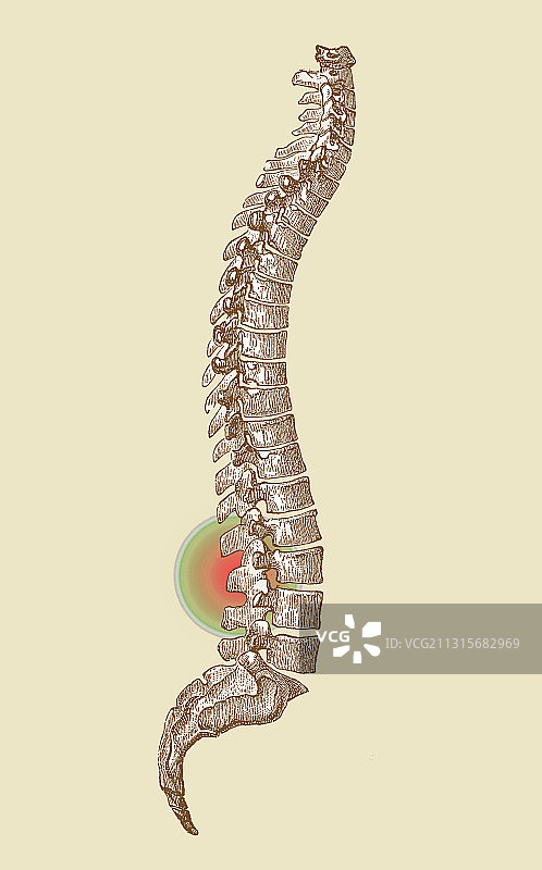 腰背疼痛图片素材