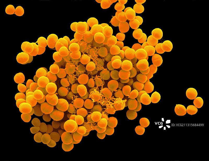 表皮葡萄球菌图片素材