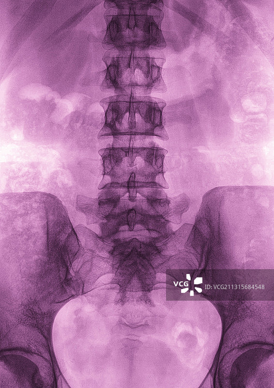 腰椎图片素材