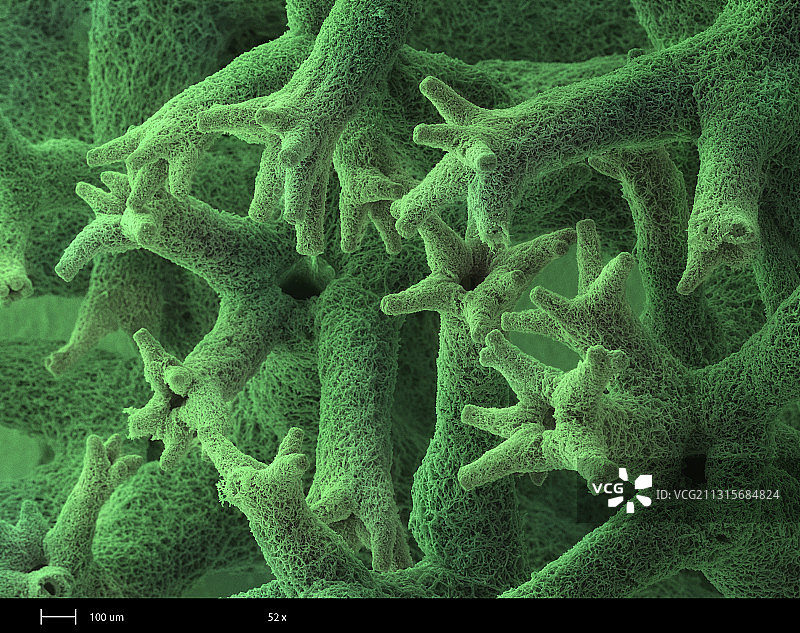 驯鹿地衣扫描电镜图图片素材