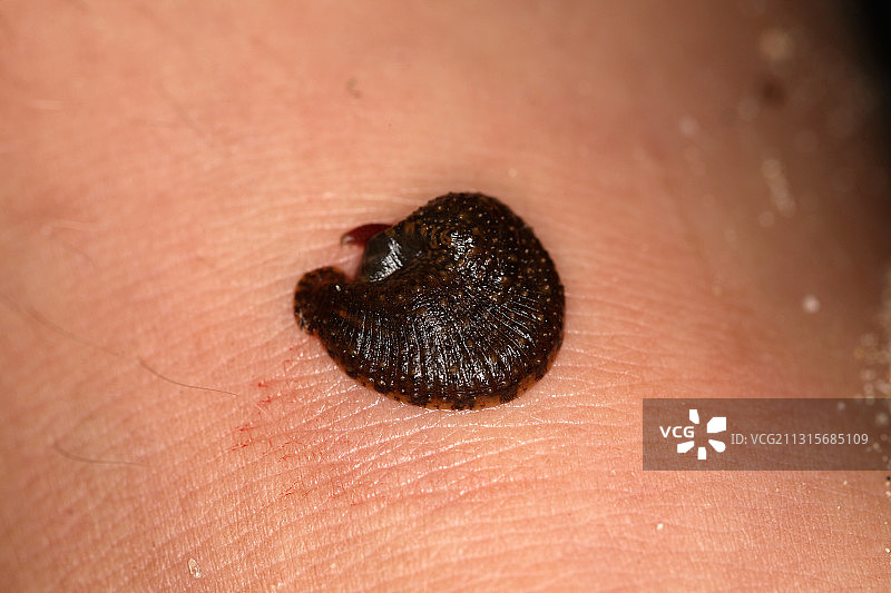 人腿上的水蛭图片素材