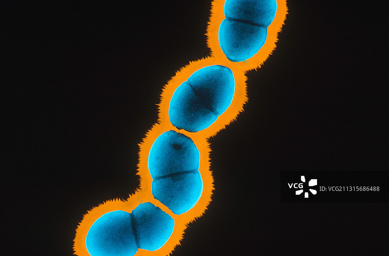 粪肠球菌，透射电子显微镜图片素材