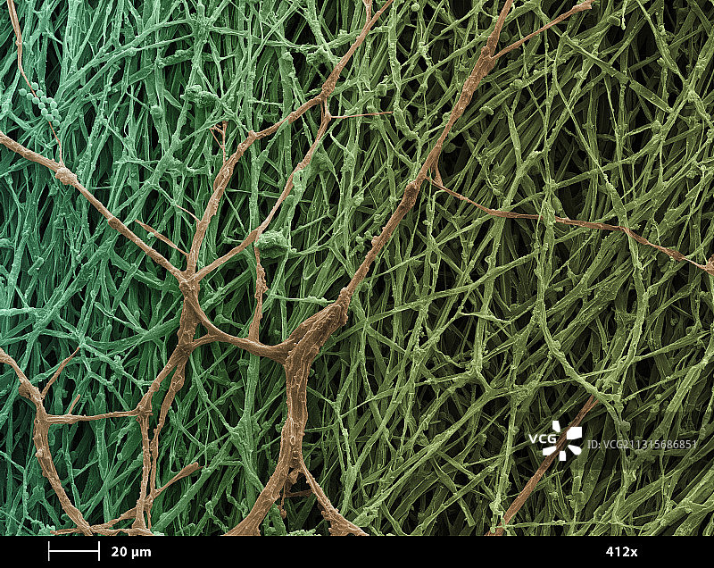 菌菇上菌丝体扫描电镜照片图片素材